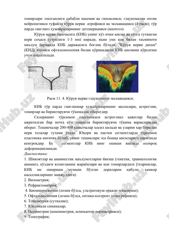 ruvchi to'qima varaqlaridan iborat. teshikchalar 200-400 kanalchalar hosil qiladi va ularni har biridan nerv tolalar tutami o'tadi. yuqori va pastki segmentlarda to'rsimon plastinka ingichka bo'lib, uning teshiklari esa boshqa qismlariga qaraganda kengroqdir. bu segmentlar kib ning oshishi vaqtida osonroq deformatsiyalanadi. diagnostika: 1. shikoyatlar va anamnestik ma'lumotlarni yig'ish (genetik, travmatologik anamnez, ko'zdagi yallig'lanish jarayonlari va qon tomirlardagi o'zgarishlar, kib ni oshirishi mumkin bo'lgan dorilarni qabuli, hamkor kasalliklarning mavjudligi) 2. vizometriya; 3. refraktometriya; 4. biomikroskopiya (lozim bo'lsa, ultratovush orqali tekshirish); 5. oftalmoskopiya (lozim bo'lsa, optika-kogerent tomografiyasi); 6. tonometriya (sutkalik); 7. yuklamali sinamalar; 8. perimetriya (kampimetriya, kompyuter perimetriyasi); 9. topografiya; 10.gonioskopiya (lozim bo'lsa - forbsning kompression sinamasi); 11. keratopaximetriya; 12. shox parda diametrini o'lchash (tug'ma glaukomalarda); 13. ultratovushli biometriya. majburiy laborator va qo'shimcha tekshiruv usullari: 1. umumiy qon tahlili 2. umumiy peshob tahlili. 3. klu uchun qon tekshiruvi 4. qonda qand miqdori 5. qon bosimi darajasi. ko'rsatmalar bo'yicha mutaxassislar maslahati: 1. terapevt 2. …