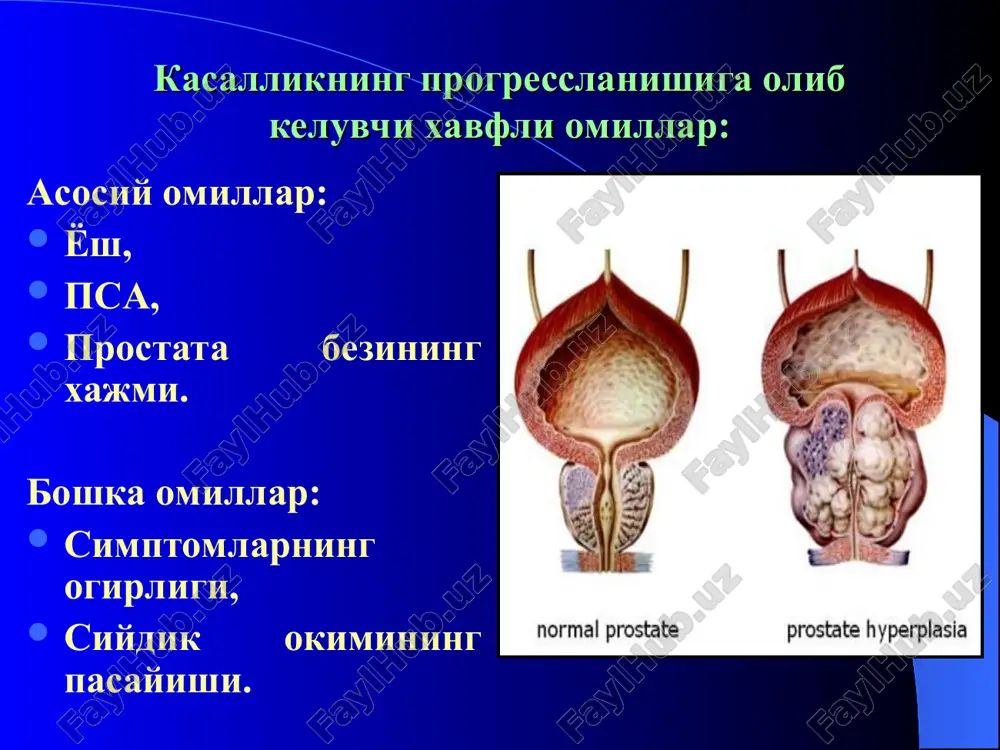 dinnaya borozda virajena sglajena ne opredelyaetsya 13. konturi rovnie nerovnie 14. granitsi chetkie nechetkie 15. razmer prostati normalnaya uvelichena umenshena 16. konsistentsiya elastichnaya tverdaya myagkaya pastoznaya flyuktuiruyushaya 17. podvijnost sli-zistoy nad prosta-toy podvijnaya fiksirovannaya 18. boleznennost boleznennaya bezboleznennaya 19. nalichie uzlov net da 20. lokalizatsiya uzlov pravaya dolya levaya dolya 21. nalichie boleznen-noy zoni indura-tsii net da 22. slizistaya pryamoy kishki podvijnaya nepodvijnaya 23. boleznennost paraprostaticheskix tkaney net est siyish kundaligi siydik mikdorini, siyish ritmi va xarakterini ob'ektiv baxolaydi: 1.siyish chastotasi 2. xar bir siyishdagi fiziologik xajm 3. nikturiyaning bor yoki yukligi 4. sutka mobaynidagi siydikning mikdori ris. 1. dnevnik mocheispuskaniy bemorning siyish kundaligi tekshiruv sanasi: tekshi-ruv kun-lari vakt/xajm (ml) vakt/xajm (ml) sutkalik ichilgan suyuklik mikdori (ml) kun tun 1. 2. 3. 4. 5. 6. 7. * siydik taxlili piuriya gematuriya proteinuriya va boshka patologik uzgarishlarni aniklash uchun bajariladi zarur bulmagan tekshiruvlar (birlamchi tekshirishda) urofloumetriya. koldik siydik mikdorini aniklash. prostata …