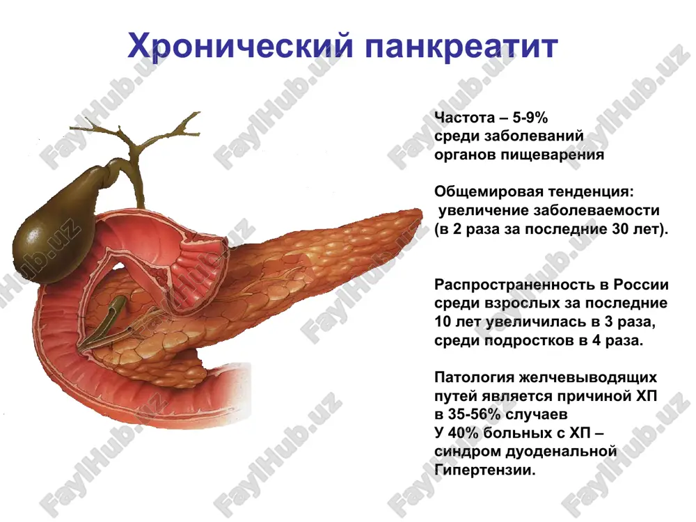 e povtoryayushiesya epizodi ostrogo pankreatita (nekroz atsinusov) na rannix stadiyax ostrogo pankreatita spontannoe prodoljitelnoe kupirovanie boli u patsientov s tyajeloy pankreaticheskoy disfunktsiey na pozdnix stadiyax pankreatita persistiruyushaya silnaya bol (ili chastie epizodi boli) obichno svyazannaya s takimi pankreaticheskimi oslojneniyami kak psevdokisti, gipertenziya vnutripankreaticheskix protokov, tak i vnepankreaticheskimi oslojneniyami (chastichnaya obstruktsiya xoledoxa, yazvi dvenadtsatiperstnoy kishki) bolevoy sindrom pri xronicheskom pankreatite bolevoy sindrom vstrechaetsya u bolshinstva patsientov i yavlyaetsya naibolee yarkim proyavleniem zabolevaniya bolee chem u polovini patsientov bolevoy abdominalniy sindrom imeet visokuyu intensivnost i soxranyaetsya dlitelnoe vremya boli usilivayutsya na fone priema pishi, obichno cherez 30 min i provotsiruyutsya obilnoy, jirnoy, jarenoy, kopchenoy i v menshey stepeni ostroy pishey, alkogolem i gazirovannimi napitkami otsutstvuet tolko u 15-16 % patsientov, kotorie xarakterizuyutsya kaltsifikatami v parenxime pj, steatoreey i saxarnim diabetom, to est znachitelnim progressirovaniem zabolevaniya eti dannie podtverjdayut rol vnutriprotokovogo povisheniya davleniya v patogeneze boli i usilenie boley posle prinyatiya pishi posledovatelnost …