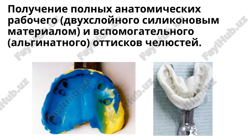 erjashiysya v gele glitserin mojet meshat otverjdeniyu ogneupornoy massi. 28 v sovremennoy stomatologii dlya dublirovaniya modeley ispolzuyutsya silikonovie dubliruyushie materiali (rema-sil, neo-star (dentarium), silatec (dmg), precisil (bego) i dr.). preimushestva silikonov: • ochen tochnoe vosproizvedenie formi i relefov; • model ne nado zamachivat; • primerno cherez 45 minut, nachinaya s momenta smeshivaniya, negativnaya forma gotova dlya dalneyshey raboti; • vozmojna povtornaya zalivka ogneupornoy massoy dlya polucheniya kontrolnoy modeli; • net reaktsii mejdu materialom formi i pakovochnoy massoy. nedostatkami silikonov yavlyayutsya visokaya po sravneniyu s gelevimi massami stoimost i vozmojnost odnokratnogo primeneniya. dublirovanie kombinirovannoy modeli 31 poluchenie ogneupornoy modeli 32 dlya izgotovleniya ogneupornoy modeli ispolzuyut massi: «silamin», «kristosil», «byugelit». posle zatverdevaniya modeli iz ogneupornoy massi neprochnie, poetomu oni podvergayutsya sushke v sushilnom shkafu pri temperature 200-250 s v techenie 30-40 min i zakrepleniyu v spetsialnom rastvore. perenos risunka karkasa na ogneupornuyu model protsess modelirovaniya karkasa byugelnogo proteza predusmatrivaet sleduyushuyu posledovatelnost deystviy …