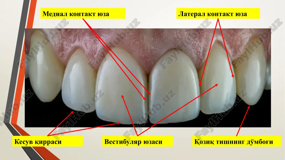 gan dentinni puxta va to'liq olib tashlash. “ogohlantirish uchun kengaytirish” – karies kovakni tishni immun zonalargacha, retsidiv kariesni oldini olish maqsadida profilaktik kengaytirish. chaynash vaqtida tish va plombani bosimga chidamligini ta'minlash maqsadida kovakni qutisimon shakllantirish. karies kovaklarni charxlash tartibi bosqich asboblar qurilma (dastak) tezlik kovakni ochish olmos yoki qattiq qotishmali borlar turbinali bormashina 250000 – 300000 kovakni profilaktik kengaytirish olmos yoki qattiq qotishmali borlar turbinali bormashina 250000 – 300000 nekroektomiya qattiq qotishmali borlar mikromotor 500 – 2000 ekskavatorlar qo'l asboblari – kovakni shakllantirish olmos yoki qattiq qotishmali borlar turbinali bormashina 250000 – 300000 kovak chetlarini finirlash mayin qirindili olmos borlar, qattiq qotishmali finirlar mikromotor 500 – 10000 emal pichoqlari, milk egati uchun trimmerlar qo'l asboblari – “eski” plombani olish yuqori kesish hususiyatli olmos yoki qattiq qotishmali borlar turbinali bormashina 250000 – 300000 shakllantirilgan karies kovak elementlari kovak chetlari – kirish teshigini o'rab turuvchi qirra bo'lib, hosil bo'lgan karies kovakni tish …