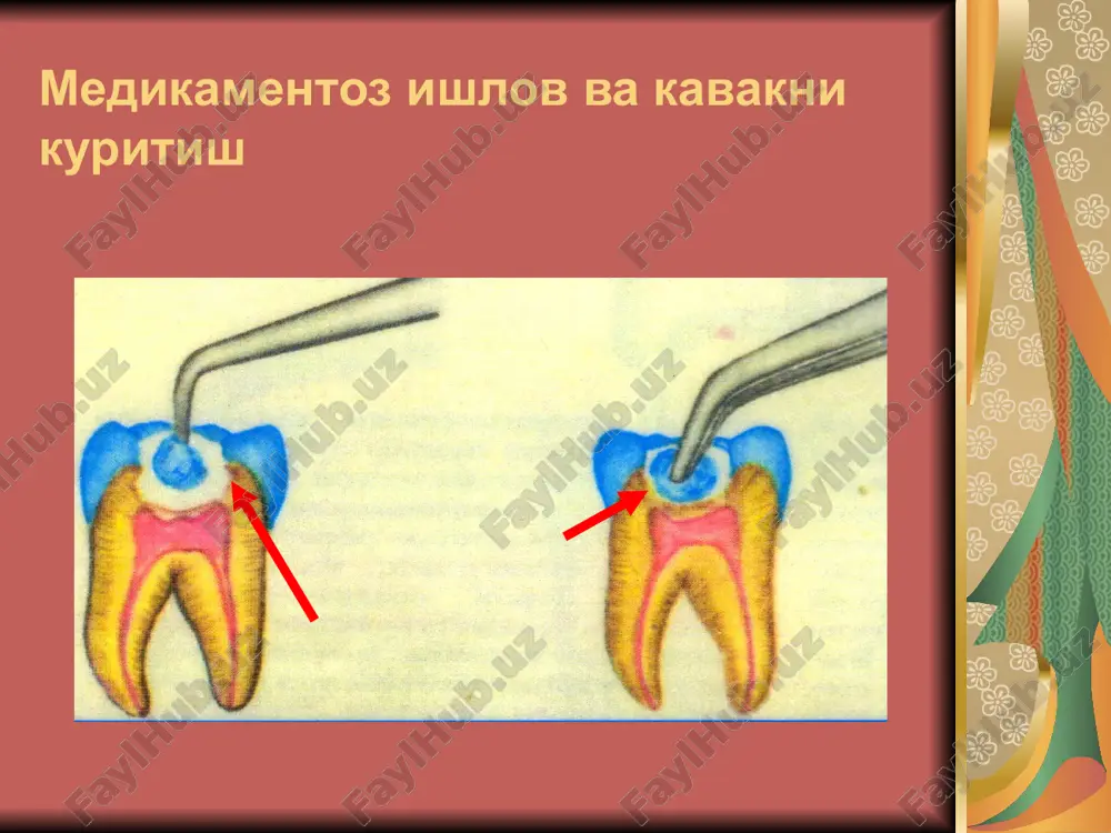pulpitlarni davolash - Page 5