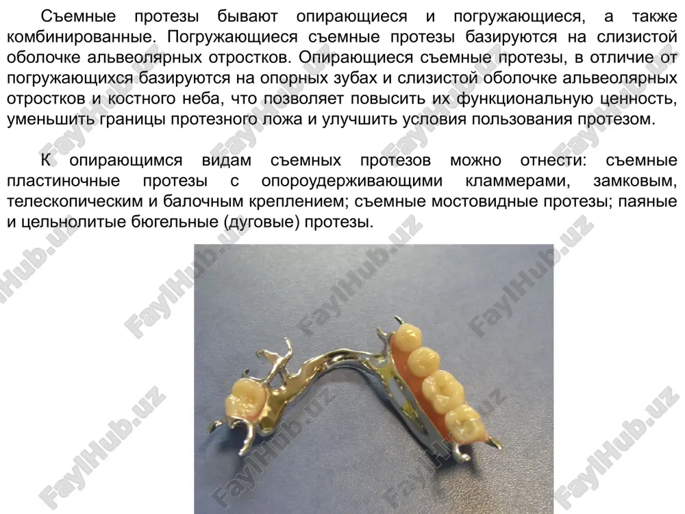 yu byugelnimi protezami - rasshatannost zubov, svyazannaya s zabolevaniem parodonta. v dannoy situatsii primenyayut shiniruyushiy byugelniy protez. konstruktsionnie elementi byugelnix protezov, ix naznachenie. byugelnie (dugovie) protezi otnosyatsya k raznovidnostyam chastichno-s'emnix opirayushixsya protezov. ix nazvanie opredelyaetsya nalichiem peremichki v vide dugi, raspolojennoy poperechno na nebe ili s oralnoy storoni na nijney chelyusti. dugovie protezi sostoyat iz metallicheskogo karkasa, v kotoriy vxodyat oporno-uderjivayushie i razgrujayushie elementi, duga, krepleniya dlya sedel, bazis s iskusstvennimi zubami. duga byugelnogo proteza. eto element dugovogo proteza, soedinyayushiy ego chasti. pri etom poluchaetsya blok soprotivleniya, kotoriy daet funktsionalno vigodnuyu nagruzku opornix zubov. glavnoy ego funktsiey yavlyaetsya ob'edinenie vsex elementov opirayushegosya proteza. duga doljna bit prochnoy, jestkoy, obladat xoroshimi fiziko-mexanicheskimi svoystvami. raspolojenie dugi na verxney i nijney chelyusti zavisit ot topografii defekta zubnogo ryada, relefa alveolyarnogo otrostka, formi neba, virajennosti torusa i drugix faktorov. naibolee blagopriyatnoy formoy dugi yavlyaetsya ovalnaya, polukruglaya, poluovalnaya. kraya dugi doljni bit zakrugleni, vo izbejanie …