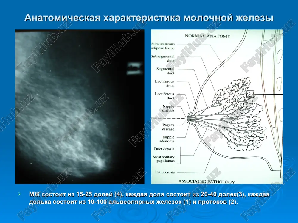 a razvitiya raka na fone proliferativnix form mastopatii zavisit ot dlitelnosti zabolevaniya i perioda nablyudeniya za patsientkoy; osobennostey traktovki pogranichnix sostoyaniy – predraka i raka; gormonalno-immunologicheskogo statusa i i individualnix vzaimootnosheniy v sisteme «organizm – proliferativnaya tkan molochnoy jelezi» kliniko-rentgenologicheskaya klassifikatsiya fkb. (po n.i. rojkovoy, 1998) i. diffuznaya forma: - adenoz s preobladaniem jelezistogo komponenta; - mastopatiya s preobladaniem fibroznogo komponenta; - mastopatiya s preobladaniem kistoznogo komponenta; - smeshannaya forma diffuznoy kistozno–fibroznoy mastopatii. - skleroziruyushiy adenoz ii. uzlovaya (lokalizovannaya) fibrozno–kistoznaya mastopatiya. klinicheskoe razvitie mastopatii 1 faza – mastalgiya (za 5-7 dney do mesyachnix + 1-2 dnya v nachale menstruatsii). 2 faza – mastalgiya + diskomfort v molochnix jelezax + nagrubanie i otek molochnix jelez (vsya 2 faza) + faza mesyachnix. 3 faza – te je izmeneniya, kak v 1 i 2 fazax + palpatorno opredelyaemie fibrozno-uplotnennie ochagi po vsey tkani molochnix jelez prakticheski ves menstrualniy tsikl. kliniko-morfologicheskaya klassifikatsiya fkb neproliferativnaya …