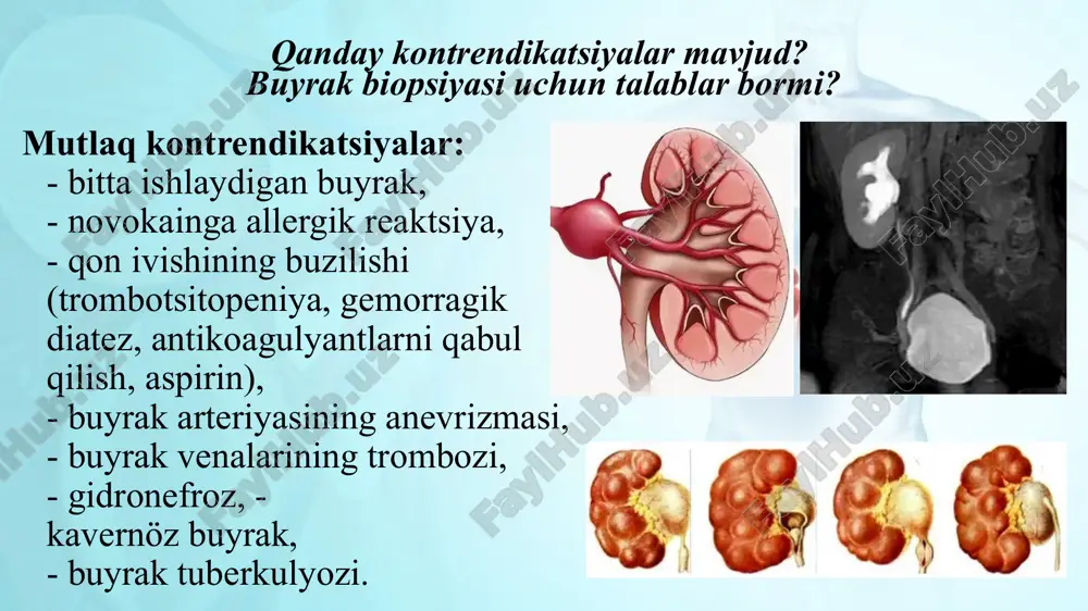 . shifokor igna kiritish joyini belgilaydi, bu joyni tozalaydi va kiritish joyini uyqusizlik uchun mahalliy og'riqsizlantiruvchi vositani (topikal anestezikani) boshqaradi, shuning uchun protsedura paytida noqulaylik odatda minimal bo'ladi. jarayon paytida va undan keyin og'riq bemorning ahvoliga bog'liq. shifokor ultratovush yoki rentgenografiya, kompyuter tomografiyasi yoki magnit-rezonans tomografiya (mri) ko'rsatmalari ostida terida kichik bir kesma qiladi va buyraklar yuzasiga ingichka igna kiritadi. bemordan chuqur nafas olish va uni 45 soniya yoki undan kamroq vaqt davomida ushlab turish so'raladi. boshidan oxirigacha butun protsedura odatda yarim soat davom etadi. ba'zida biopsiya uzoqroq, bir soat yoki undan ko'proq vaqt talab qilishi mumkin. natijalar qanday bo'lishi mumkin? buyrak biopsiyasi ? to'qima namunasi olingandan so'ng, u sinov uchun laboratoriyaga yuboriladi. to'liq biopsiya natijalari odatda 24 soatdan bir necha kungacha davom etadi. oddiy natijalar. buyrak to'qimalarining parametrlari uchun normal qiymatlar normal, o'zgarmagan buyrak tuzilishini ko'rsatadi. anormal natija buyrak to'qimalarida o'zgarishlarni ko'rsatadi. buning sababi infektsiya, buyraklar orqali qon oqimining …