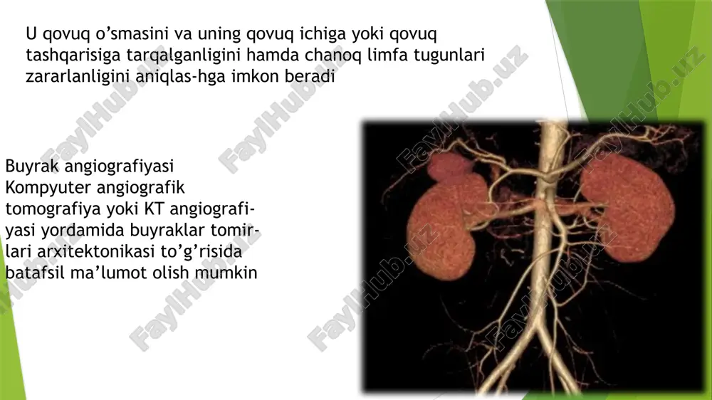 urologiya kompyuter tomografiyasi(kt) va yamr urologiya - Page 5