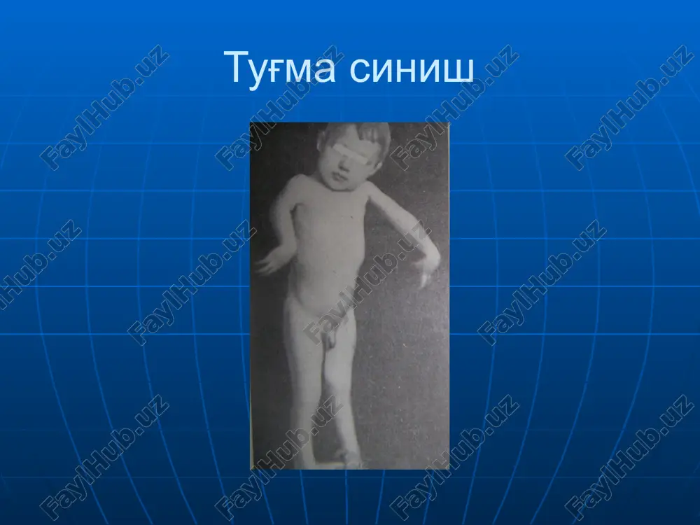 суякларнинг синиши ва чикиши - Page 5