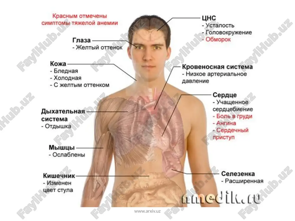 a zaharli ta’sirotlar, keksalikdagi atrofik jarayonlar natijasida ham rivojlanishi mumkin. ichki omil yetishmasligi ichakda bl2 vitamini so‘rilishining buzilishiga olib keladi va qonda bn vitamini yetishmasligi rivojlanadi. natijada folat kislotaning o‘z aktiv formasi folin kislotaga o‘tishi amalga oshmay qoladi. www.arxiv.uz klinik ko‘rinishi. kasallik kechishi siklik bo‘lib, remissiyasi retsidiv davri bilan almashinib turadi. remissiya davrida qon ishlab chiqarish normoblast bo‘lib, kasallikning klinik belgilari kuzatilmadi. kasallikka xos klinik belgilar va periferik qondagi o‘zgarishlar retsidiv vaqtda kuzatiladi. addison-birmer kasalligi, asosan, keksa yoshdagi erkaklarda uchraydi. kasallik bilintirmay rivojlanadi.uning boshlang‘ich belgi­lari quwatsizlik, tez toliqish, og‘iz qurishi, dispeptik o‘zgarishlardan iborat. kam hollarda kasallik asab a’zolaridagi o‘zgarishlar, paresteziya va sezuvchi nerv ildizlaridagi og‘riqlar bilan boshlanadi. xastalik qaytalaganda uch sindrom (kamqonlik, oshqozonichak va nevrologik) belgilar kuzatiladi. www.arxiv.uz laborator tekshiruvi natijalarida qondagi o‘zgarishlar o‘ziga xos, pernitsioz anemiya giperxrom boladi: rang ko‘rsatkichi birdan yuqori (eritrotsitlar umumiy miqdori kamayganda, ulardagi ge- moglobin miqdori oshgan boladi), yirik eritrotsitlar— makrotsitlar, shuningdek, poykilotsitlar (odatdagi yumaloq …