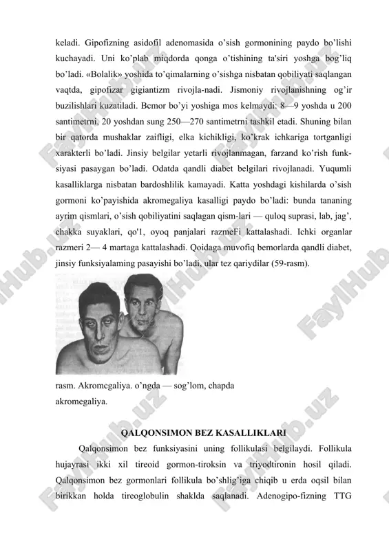 onini follikula kolloiddidan qonga ajratadi. yodsiz tireoid gormoni sintez bo’lmaydi va qalqonsi-mon bez qonda yodni so’rib oladi. qalqonsimon bezda yana bir gormon, paratgarmon antagonisti bo’lgan kalsitonin ishlab chiqarib, u qondagi kalsiy miqdorini kamaytiradi. qalqonsimon bez gormoni amalda organizmdagi hamma jarayonlarda qatnashadi. u jismoniy, ruhiy va jinsiy rivojlanishni belgilaydi, to’qimalar o’sishini takomillashishini suyaklanishni rag’batlantiradi. tireoid gormonining barcha xususiyatlari ichida uning to’qima-larda oksidlanishni, issiqlik ajratishni ko’paytirishni, oqsil, yog’, uglevod parchalanishini kuchaytirishni rag’batlanti-ruvchi ta'sirini ko’rsatib o’tish kerak. buyrak usti bezi mag’iz moddasi funksiyasi ortishi bilan kechuvchi kasalliklar bu kasalliklar ichida eng katta ahamiyatga ega bo’lgani mana shu to’qimadan hosil bo’lgan yaxshi sifatli o’sma-feoxromositoma yoki uning yomon sifatli xilifeoxromob-lastomadir. feoxromositomaning o’sishi katta miqdorda katexolaminlar paydo bo’lishi va ularni vaqti-vaqti bilan qonga tushish bilan birgalikda ketadi. kasallik xuruj, kriz ko’rinishida kechib arterial bosimning ortiq darajada — (200 mm simob ustinidan ortiq) keskin ko’tarilishi bilan xarakterlanadi. qalqonsimon bez giperfunksiyasi bilan kechuvchi kasalliklar bu kasalliklar qalqonsimon bezning …