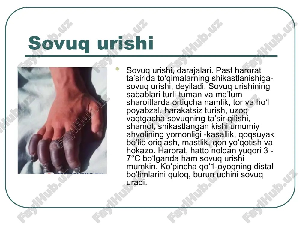 cho`kishlar, sovuq urishi va issiq urushlari - Page 5