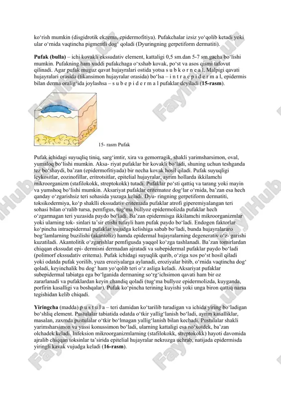sh yoki qo‘ng‘ir- qizg‘ish, shakli yarim sharsimon bo‘ladi. do‘mboqcha infiltrati granulyomadan, ya’ni limfotsitlar, gigant va epitelioid hu- jayralardan iborat bo‘ladi. keyinchalik do‘mboqcha markazi nekrozga uchrab, qora qo‘tir bilan qoplanib turadigan yara hosil bo‘ladi. ba’zan do‘mboqchaning so‘rilishi hisobiga uning o‘rnida atrofiyali chandiq qoladi. do‘mboqcha, masalan, sil volchankasida ko‘prikchalar (kazeoz-nekrozdan keyin) hosil qilishi bilan bitsa, zaxmda naqshga o‘xshash shakllarni yuzaga keltiradi va buning klinik ahamiyati katta. turli kasalliklarda do‘mboqchalar o‘ziga xos rangga ega bo‘ladi. masalan, uchlamchi zaxmda qizg‘ish- jigarrang, sil volchankasida qizg‘imtir, moxovda to‘q bug‘doy rang va hokazo. ko‘pgina kasalliklarda do‘mboqchalar o‘zining gistomorfologik tuzilishi bilan farq qiladi. masalan, sil volchankasida do‘mboqchalar aksariyat epitelioid hamda langxansning gigant hujayralaridan tashkil topadi, ba’zan sil mikobakteriyalarini topish mumkin, zaxmda esa do‘mboqcha plazmatik epitelioid hujayralar, limfotsitlar va fibroblastlardan iborat bo‘lib, gis- tologik preparatlarda oqish treponemalar topilmaydi. odatda do‘mboqchalar badanning turli qismlarida joylashadi, ba’zan ular bir-biri bilan qo‘shilib katta infiltratlar hosil qiladi. do‘mboqchalar asosan zaxm, sil volchankasi, moxov, …