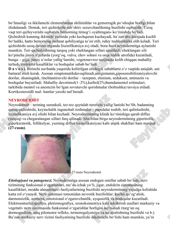 va uyqu bilan davolash yaxshi samara beradi. organizmning sensibilizatsiya, allergik holatini yo‘qotish uchun kalsiy birikmalari (kalsiy xlorid, kalsiy glyukonat), natriy tiosulfat tavsiya etiladi. davolashning birinchi kunidan boshlab antigistamin dorilar (tavegil, fenkarol, suprastin, dimedrol va boshqalar) terapevtik miqdorda buyuriladi. ekzema og‘irroq kechganda bemorni kasalxonaga yotqizib, kortikosteroid dorilar bilan davolaniladi, ularning kunlik o‘rtacha miqdori 30-40 mg.ni tashkil etadi. davolash kompleksiga vitaminlar, ayniqsa, v guruh vitaminlar, nikotin kislotasi (vitamin rr) va boshqalarni qo‘shish tavsiya etiladi. seboreyali ekzemada yuqorida keltirilgan dorilardan tashqari e vitamin (tokoferol) buyuriladi (ekzemani davolashda ishlatiladigan dorilarning miqdori, qo‘llash usullari «teri kasalliklarini davolashning asosiy tartibi» bo‘limida batafsil aytib o‘tilgan). davolash chog‘ida, shuningdek, undan keyin ham parhezga rioya qilish, tuxum yemaslik, qovurilgan, achchiq, sho‘r, moshli ovqatlar iste’mol qilmaslik va spirtli ichimliklar ichmaslik talab etiladi. m a h a l l i y d a v o har bir bemor organizmining o‘ziga xos tomonlari hamda kasallikning turi va klinik kechishiga qarab olib boriladi. …
