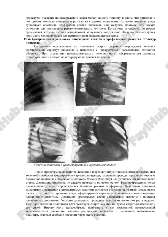 utstvii simptomov perforatsii vipolnenie egds sleduet otlojit do razvitiya vospalitelnix izmeneniy, t. e. do 48-72 ch (neznachitelnoe vospalenie poyavlyaetsya uje v techenie pervix sutok), chto pozvolyaet tochno opredelit rasprostranennost porajeniya. s pomoshyu endoskopicheskogo issledovaniya udaetsya viyavit povrejdenie slizistoy obolochki, odnako ono ne pozvolyaet ustanovit glubinu porajeniya. pri obsledovanii patsientov s ximicheskimi ojogami pishevoda nelzya schitat tochnimi pokazatelyami tyajesti ximicheskogo povrejdeniya. pri kontakte ximicheski agressivnix veshestv so slizistoy obolochkoy rotoglotki bol chasto voznikaet nemedlenno, chto privodit k udaleniyu edkix veshestv iz polosti rta do glotaniya. poetomu u patsientov, prinyavshix takie veshestva, mogut viyavlyatsya simptomi porajeniya rotoglotki bez priznakov povrejdeniya pishevoda. naprotiv, nesovmestnie s jiznyu ojogi pishevoda poroy sochetayutsya s minimalnimi priznakami povrejdeniya slizistoy obolochki rotoglotki. takim obrazom, simptomi porajeniya rotoglotki ne yavlyayutsya dostovernimi priznakami tyajesti porajeniya pishevoda i jeludka. rasprastranennost i tyajest porajeniya, vizvannogo kislotami i shelochami, v ravnoy stepeni zavisit kak ot osobennostey ximicheskogo veshestva, tak i ot proglochennogo ob'ema …
