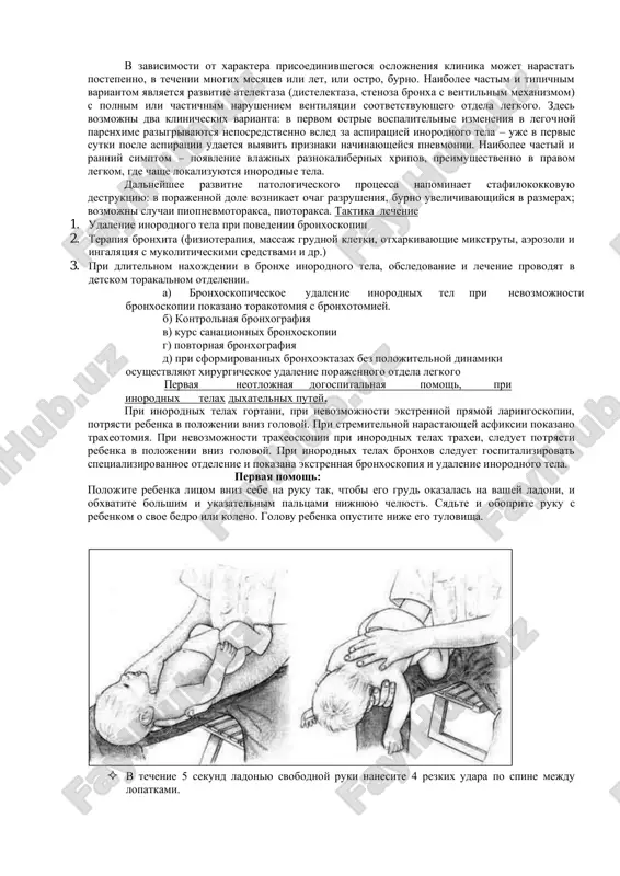 aticheskaya pnevmoniya) i razvitiyu v dalneyshem bronxoektaziy. pri chastichnoy obtyuratsii prosveta bronxa inorodnim telom mojet razvitsya ventilniy mexanizm s obrazovaniem emfizematoznix vzdutiy legochnoy parenximi k periferii ot prepyatstviya i vozmojnim razvitiem pnevmotoraksa. ventilniy mexanizm naibolee chasto privodit k destruktivnim izmeneniyam parenximi legkogo. pri nalichii ventilnogo mexanizma pri auskultatsii vislushivaetsya usilennoe, forsirovannoe dixanie, inogda udaetsya ulovit svistyashiy zvuk proxojdeniya vozduxa cherez stenozirovanniy bronx. k periferii dixanie oslableno, pri perkussii opredelyaetsya korobochniy ottenok. na obzornix rentgenogrammax viyavlyaetsya emfizematozniy uchastok (povishennaya prozrachnost, «obednenie» legochnogo risunka). inorodnoe telo pravogo promejutochnogo bronxa s atelektazom nijney i sredney doli . metallicheskiy shurup. emfizematoznaya vzdutiya pravogo legkogo. v nekotorix sluchayax skritiy period voobshe mojet otsutstvovat, i neposredstvenno vsled za periodom ostrix respiratornix narusheniy razvivaetsya period oslojneniy. eto nablyudaetsya pri prisoedinenii takix oslojneniy, kak pnevmotoraks, mediastinalnaya emfizema, krovotechenie, ostriy totalniy atelektaz s dixatelnoy nedostatochnostyu. period oslojneniy razvivaetsya v rezultate raznoobraznogo patologicheskogo vozdeystviya inorodnogo tela na stenki bronxa i …