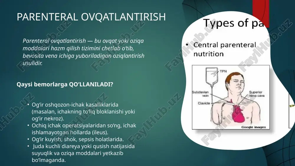 i. ratsionda uglevod va xolesterin cheklangan bo‘lishi zarur. qora non, sabzavotlarga boy sho’rvalar, yog’siz baliq va mol go’shtini iste’mol qilish mumkin. manniy yormasi, makaron, mandarin, shirinliklar, shirin mevalar, guruch, tuxum, sabzi, kartoshka, qizil lavlagi, asal, (kam miqdorda) tavsiya etiladi. 9-parhez stoli 10-parhez stoli 10-sonli parhez stoli yurak-qon tomir kasalliklarida buyuriladi. bunda tuz, hayvon yog‘lari, xolesterin cheklanadi. ko’proq meva-sabzavotlar, turshak, baliq (laqqa), qora uzum, anjir, o’rik, ko‘k olma, suli, tariq, grechka yormasidan bo‘tqalar iste’mol qilishni bemorga tavsiya qilinadi. yog‘li go’shtlar, xamir, baliq uvildirig‘i, spirtli ichimliklar, konservalar, kofe, ot go’shti, kaloriyasi kuchli ovqatlar yeyish man qilinadi 11-parhez stoli 11-sonli parhez stoli yuqumlikasalliklardan so‘ng (sil kasalligida hamda jarrohlik amaliyotini boshidan o‘tkazgan bemorlarga) buyuriladi. bunda oqsillar va minerallarga boy mahsulotlar tavsiya etiladi. kunlik ratsionda oqsillar 110-130 gr (60% hayvon oqsili), yog‘lar 100-120 gr, uglevodlar 400-450 gr, energetik ahamiyati 3000-3400 kkal bo‘lishi zarur 12-parhez stoli 12-sonli parhez stoli asab tizimi kasalliklarida buyuriladi. bunday bemorlarga ziravorlar, …