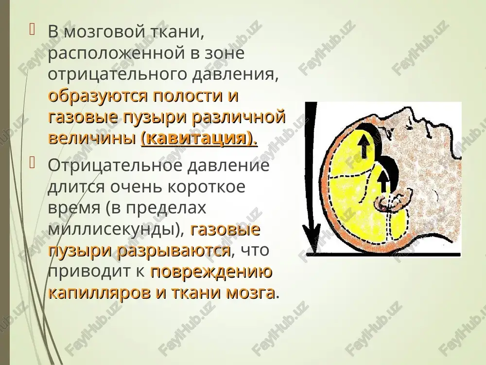 elov golovnogo mozga, no v bolshey stepeni povrejdeniem stvolovix otdelov golovnogo mozga i dientsefalnoy oblasti. klinika: s momenta tyajeloy travmi postradavshie naxodyatsya v komatoznom sostoyanii. dlitelnost utrati soznaniya mojet bit ot neskolkix dney do neskolkix nedel, mesyatsev. srazu voznikayut narusheniya dixaniya tsentralnogo xaraktera, k kotorim bistro prisoedinyayutsya perifericheskie dixatelnie rasstroystva. grubie vegetativnie, glazodvigatelnie i bulbarnie narusheniya. tetraparez, izmeneniya mishechnogo tonusa, dvuxstoronnie patologicheskie refleksi. mojet bit obuslovleno : vnutricherepnoy gematomoy (epiduralnoy, subduralnoy, vnutrimozgovoy, vnutrijeludochkovoy). vdavlennim perelomom kostey svoda cherepa. kontuzionnim ochagom, vizivayushim otek i smeshenie golovnogo mozga. subduralnoy gidromoy. sdavlenie golovnogo mozga vnutricherepnie gematomi epiduralnaya gematoma - eto ogranichennoe skoplenie krovi mejdu narujnoy poverxnostyu tverdoy mozgovoy obolochki i kostyami cherepa. istochnikom vozniknoveniya epiduralnoy gematomi yavlyaetsya povrejdennaya vetv obolochechnix arteriy. chashe vsego proisxodit razriv sredney obolochechnoy arterii. subduralnaya gematoma - eto skoplenie krovi pod tverdoy mozgovoy obolochkoy. ona voznikaet, chashe vsego, pri povrejdenii ven, idushix ot poverxnosti mozga k venoznim sinusam. vnutrimozgovaya …