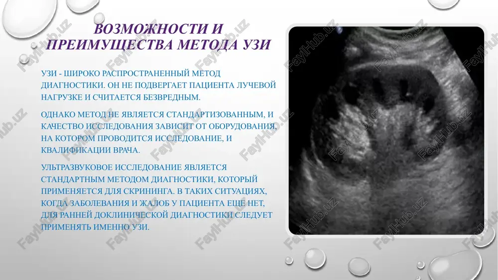ri budut ispolzovatsya rezultati analizov krovi, mochi i drugix biologicheskix materialov, dannaya sfera nikuda ne ischeznet. meditsinskie programmi na telefone! v nastoyashee vremya sozdano mnojestvo programm, s pomoshyu kotorix patsienti ne vixodya iz doma mogut otsenit sostoyanie svoego zdorovya! odnako, pravilnost i tochnost etix programm ne smojet dat dostovernogo otveta o zdorove! kardiograf - cardiograph prilojenie kardiograf pozvolit vladeltsam android ustroystv v lyubom meste i v lyuboe vremya izmerit chastotu serdechnix sokrasheniy prilojiv palets k kamere. poluchennie dannie soxranyayutsya v istorii profayla i dostupni dlya prosmotra. icare monitoring arterialnogo davleniya izmeryaet ad cherez telefon, pogreshnost za plyus i minus 12 kalkulyator indeksa massi tela indeks massi tela predstavlyaet soboy kompaktniy i krasochniy prilojenie, kotoroe vichislyaet massu tela lyudey indeksom, osnovannim na takie faktori, kak pol, vozrast, rosta i vesa. shagomer programma, kotoraya umeet schitat vashi shagi i zapisivat ix, chtobi vi mogli uznat, kakoe rasstoyanie uje proshli, skolko kaloriy sojgli …