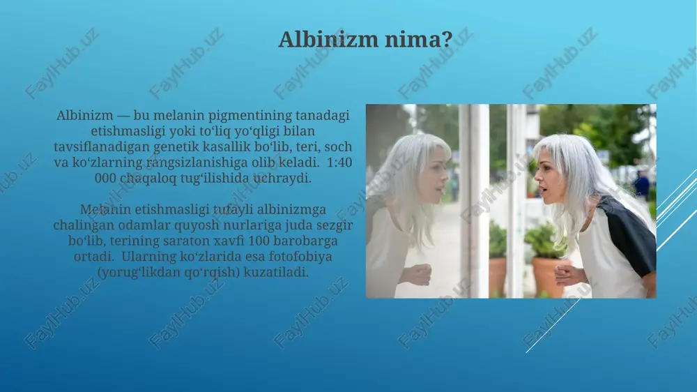 albinizm kasalligi - Page 5