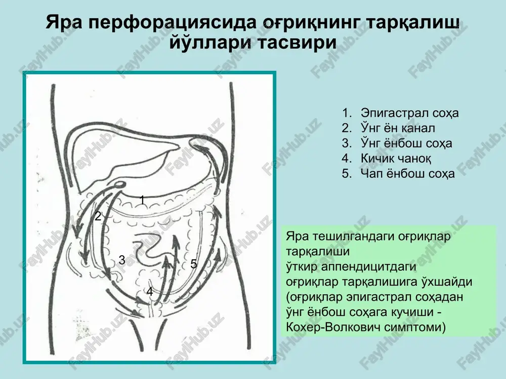 yara perforatsiyasini tasnifi(b.d.komarov, v.s.savelev) - Page 5