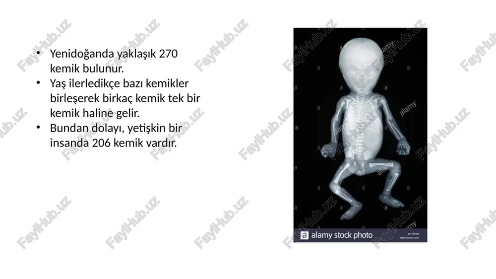 (ossa informia, ossa irregularia) principles of anatomy and physiology kemikleşme kemikler mezenşim kaynaklıdır. bir yerde kemik gelişeceği zaman, önce mezenşim doku oraya yerleşir, bu iki şekilde gerçekleşir: 1. intramembraneous (bağ doku kaynaklı) kafa tası gibi bazı kemikler, direk bağ dokusundan gelişir. 2. intracartilageneous (kıkırdak doku kaynaklı) önce kıkırdak doku haline döner, kıkırdak doku zemininde de kemik teşekkül eder. kemik matriksi (osteoid) meydana geldikten sonra, bunun üzerine madeni tuzlar oturur -endokondral (içten) kemikleşme -perikondral (dış yüzeyden) kemikleşme intramembranöz kemikleşme temel olarak yassı kemiklerde görülür mezenkimal dokudan gelişir kemikleşme sahasında bağ dokusu hücreleri, osteoblastlara dönüşür. osteoblastlar, osteoid maddesini daha sonra kollajen liflerini salgılayarak kemiğin matrixini yapar matrixte nokta şeklinde tuz oturması görülür. (kemikleşme merkezi) kemikleşme merkezleri birleşerek bütün kemik oluşur trabeküllerin şekillenir. periosteum gelişir. perikondral kemikleşme: uzun kemiklerde görülür. kemiklerin enine büyümesi, periostun iç tabakasında bulunan osteoblastların faaliyeti ileolur. kıkırdak doku etrafını saran perikondriumun iç yüzündeki bağ dokusu hücreleri osteoblastlara dönüşür taslağın …