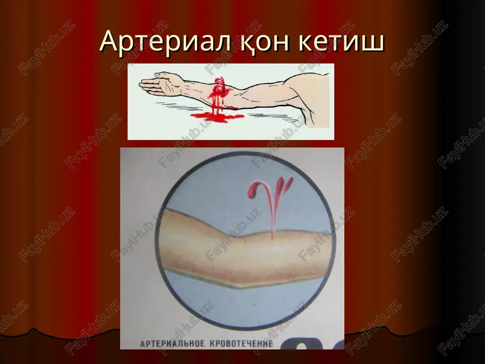 “qon ketish va uni to'xtatish usullari” - Page 5