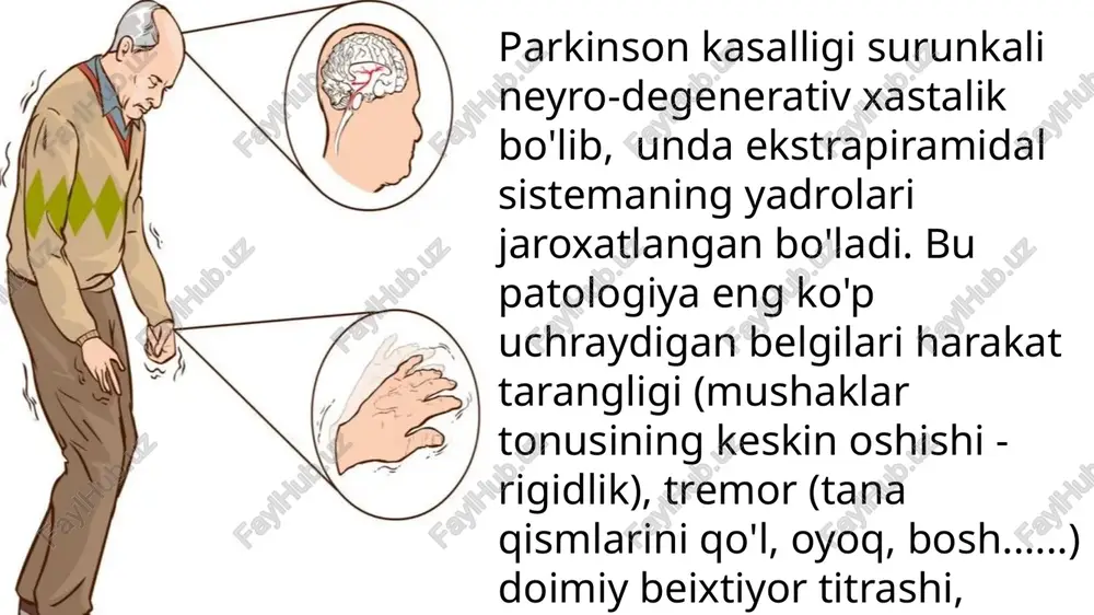 parkinson kasalligini davolash - Page 5