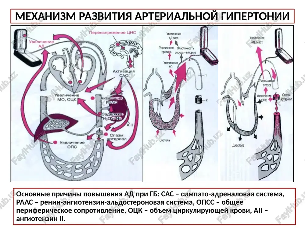 koy bolezni (nochnie smeni, dlitelnoe psixo-emotsionalnoe perenapryajenie). semeyniy anamnez, otyagoshenniy nalichiem u blijayshix rodstvennikov bolnogo gipertonicheskoy bolezni, ishemicheskoy bolezni serdtsa, saxarnogo diabeta, insulta bolshe xarakteren dlya patsientov s gipertonicheskoy boleznyu. nalichie u bolnogo vrednix privichek (kurenie, zloupotreblenie alkogolem) takje yavlyaetsya faktorami riska razvitiya gipertonicheskoy bolezni. fizikalnoe issledovanie osmotr: polojenie bolnogo s gb aktivnoe. neredko vstrechaetsya ojirenie. mojet nablyudatsya nebolshaya pastoznost nijnix, inogda i verxnix konechnostey, litsa. tsvet koji: neredko otmechayut giperemiyu litsa (rasshirenie sosudov koji pod deystviem adrenalina); mojet nablyudatsya blednost koji vo vremya gipertonicheskogo kriza (sujenie sosudov pod deystviem noradrenalina). osmotr, palpatsiya i perkussiya serdtsa: u bolnix gb verxushechniy tolchok i granitsi serdtsa mogut bit ne izmeneni ( i stadiya gb). pri gipertofii levogo jeludochka bez ego dilatatsii otmechaetsya uvelichenie sili verxushechnogo tochka, odnako ego lokalizatsiya, tak je kak i levaya granitsa otnositelnoy tuposti serdtsa, ne izmeneni ( ii stadiya gb). pri razvitii gipertrofii i dilatatsii levogo jeludochka verxushechniy …