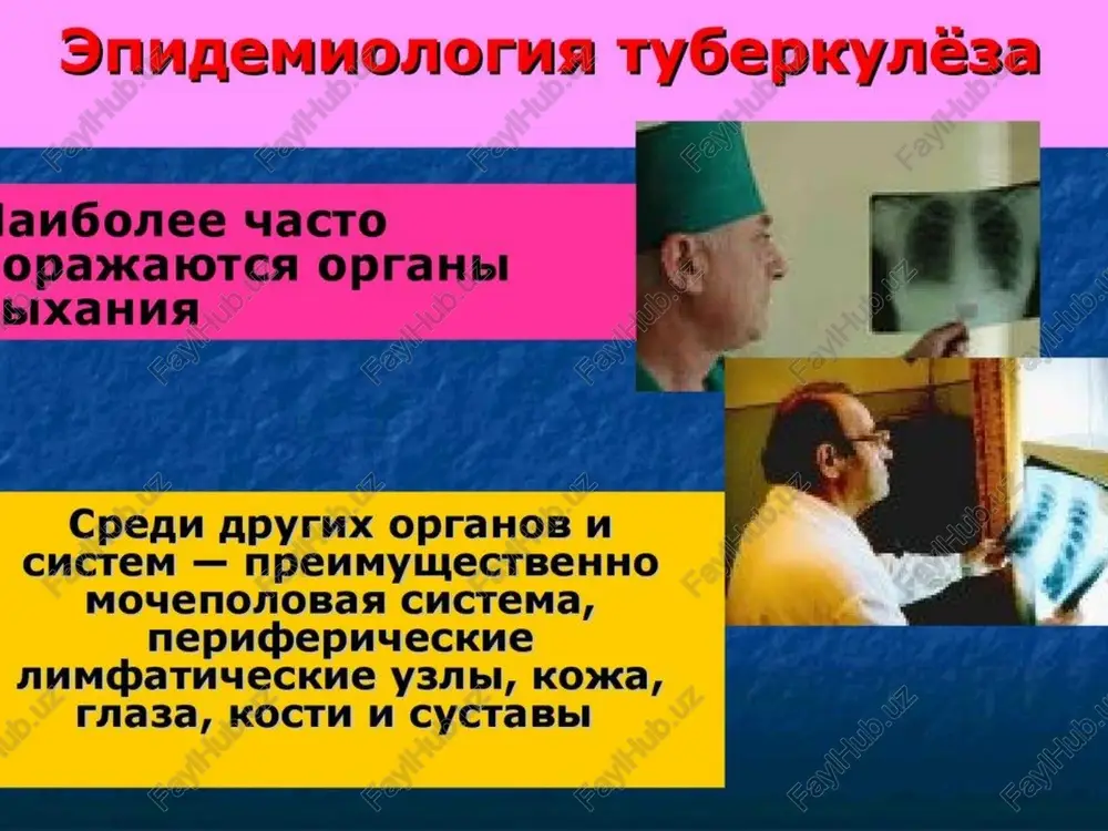 bcbect unuv ovar nepsuyhpli ty6epkyne3hbin kommnekc bapuahtbl teyehua nepbuuhoro ty6epkyne3za ¢ 3axkmb/ehne oyarob nepbuyhoro kommnekca * [porpeccupobahne c rehepanu3zaunen npouecca * xponhuyeckoe teyehue 3akubehue oyarob nepbuyhoro kommnekca netpucpukatbi b nerkom (ouar [oua): cy6nnespanbublii menkuii (0,8 cm, ctpenka) ouar o6bisbectbnehua b bepxheli aone nerkoro genoro beta, nnothom kohcmctehumn, c yetkmmm rpahulamn. nnespa hag hmm btahyta, ckneposupobana , ytonlueha, ynmotheha, ceporo libeta. pragaahss41 4 u1 n14 unimelusalamlleorelle lll lac nporpeccupobahue nepbuyhoro ty6epkynesa c rehepau3auven npouecca ®mopmobl: ¢ poct nepbuyhoro abdexta ¢ tematorehhaa * jiumoorehhaa ¢ cmmewahhaa «canuposannaa arp ay sh ipoh «coropoe serkoe» fohouieckoli 4ax' pacnag nepbuyhoro addexta uv hayao o6pa30bahna kabephbl cmewahhoe nporpeccupobahue nepsuyhoro ty6epkyne3a [tematorehhbii tyoepkkyne3 bo3hukaet nocne nepehecehhoro nepsuuhoroo ty6epkyne3a npv hanuuun oyarob rematorehhoro otceba um he bnonhe 3akubluux pokycob b aumatuyecknx y3ax. jhaorehhaa uhpekuva. ha ohe bbipaxkehhoro ummyhmtetaa k muko6aktepuam, ho nobbilughhom 4ybctbutebhoctu (cehcu6unu3zaunn kk tyyoepkyanhy). npeo6bnafaet nposyktubhaa tkahebaa peakuna (rpahynema). bblpaykeha cknohhoctb k femmatorehhon rehepanus3aunn. munuapubin ty6epkynes …