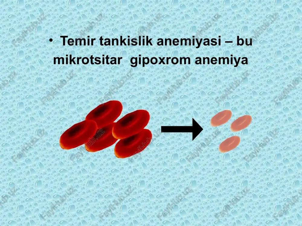 temir tanqislik anemiyasi - Page 5