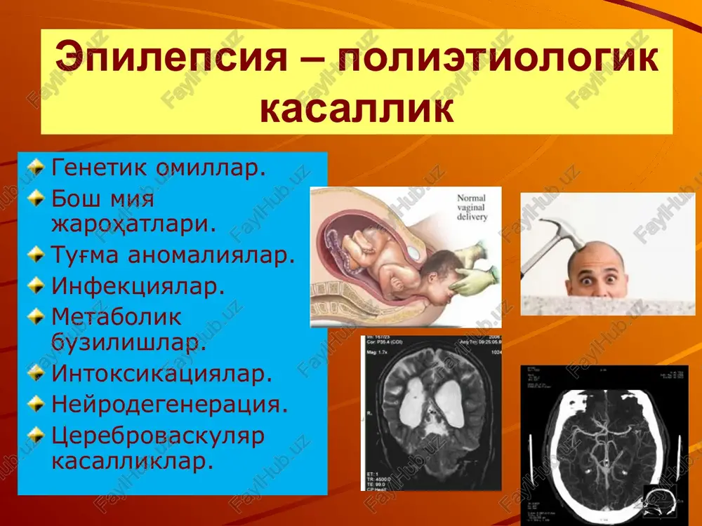 epilepsiya - Page 5