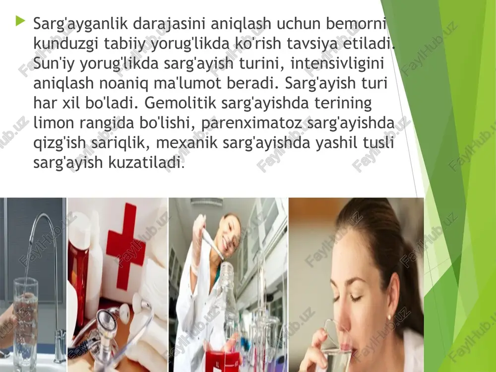 ishlar, disse bo'shliqlari orqali qonga o'tadi. o't bilan birga qonga bog'langan bilirubindan tashqari o't kislotalari ham o'tadi bu kuchli teri qichishi bilan namoyon bo'ladi. bog'langan glyukuronid bilirubin suvda erigani uchun u siydik bilan chiqadi: bilirubinuriya kuzatiladi. o't ichakka tushmasligi sababli axlat turg'un oqargan holda bo'ladi, siydikda urobilin aniqlanmaydi. mexanik sarg'ayishda erkin holdagi bilirubinning qonda biroz oshishi gepatotsitlarda uning kon'yugatsiyasining pasayishi tufayli yuz beradi. jigar faoliyati dastlabki davrlarda kam buzilgan bo'ladi, bemorda xolestazning kilinik va bioximik belgilari, giperxolesterinemiya, ishqoriy fosfataza va 5- nukleotidaza miqdorining ko'tarilishi aniqlanadi mexanik sarg'ayishga olib kelgan sabablarning nozologik turlariga qarab kasallikning kilinik manzarasi har xil bo'ladi (o't tosh kasalligi, oshqozon osti bezi boshi raki, o't pufagi va faterov so'rg'ichi raki, jigarning birlamchi va ikkilamchi saratonlari va boshqalar). portal gipertenziya sindromi portal gipertenziya darvoza venasida qon bosimining turg'un ko'tarilishi, portokaval anastomozlarning kengayishi, astsit paydo bo'lishi va taloqning kattalashishi bilan namoyon bo'ladi. ma'lumki, portal vena taloqdan, oshqozon osti bezidan, …