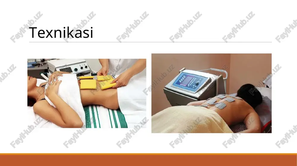 12-15 muolaja. interferentsterapiya bemorning tanasiga ikki (yoki undan ortiq) elektrod jufti ishlatiluvchi, o'rtacha teng bo'lmagan chastotalarning ikki tok (yoki ko'proq) bilan ta'sir etuvchi, interferentsiya toklaridan terapevtik foydalanish usuli hisoblanadi. (interferensiya- birga qo’llash lot. inter - o'rtasidagi ferens (ferentis) - «tashuvchi»). to'qimalar ichida toklarning o'zaro ta'siri natijasida past chastotali yangi o'zgaruvchan (interferentsion, h. nemek toki ) tok hosil bo'ladi. bu tebranishning amplitudasi muntazam ravishda o'zgarib turadi va urish deb nomlanuvchi tebranishlarni hosil qiladi. ularning (urish) soni yetkazib beriladigan toklarning chastotalaridagi farqlar bilan aniqlanadi (2.9-rasm). teri bunday toklarga nisbatan qarshiligi past, bu esa chuqur joylashgan a'zolar va to'qimalarga ta'sir qilishiga imkon beradi. interferents toklarni shakllantirish sxemasi interferentsiya toklarining analgetik ta'siri- diadinamik toklar ta'siriga o'xshaydi, u kamroq ko'rinadi, ammo bemorning chuqur joylashgan to'qimalarida shakllanadi. interferentsion toklar vazoaktiv moddalarni ajralishini kuchaytiradi, magistral arteriyalar va kapillyar tonusini qayta tiklaydi, faol kollateral sonini ko'paytiradi va mikrosirkulyatsiyani tezlashtiradi. ushbu usulning kamchiligi maydon jihatdan cheklangan sohaga ta'sir etishda …