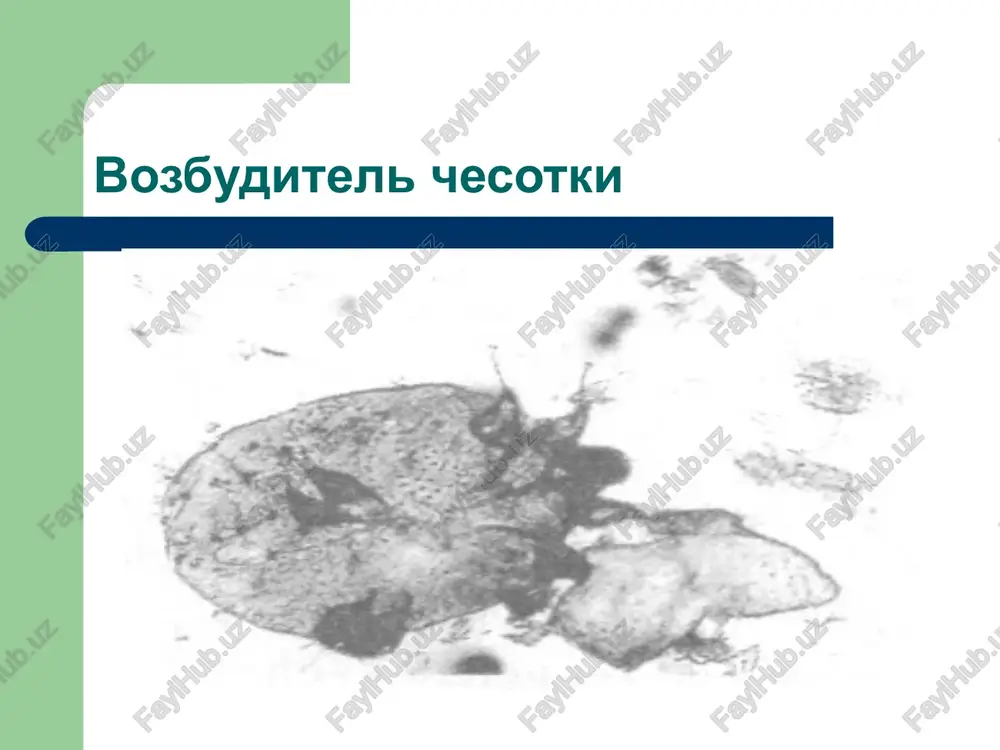 chesotka (scabies) - Page 5