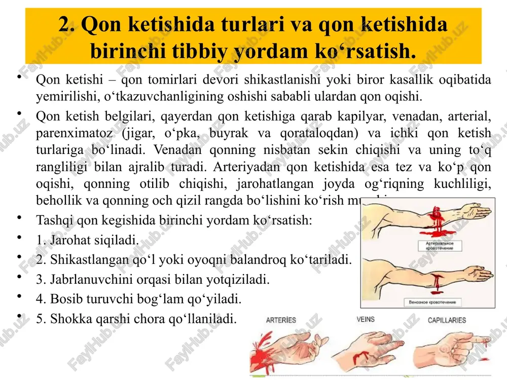akning bo‘g‘imdagi o‘z normal holatiga nisbatan siljishidir. chiqish, odatda, katta kuch ta’siri ostida ro‘y beradi. suyak boshchasi o‘zining normal holatidan tashqari chiqsa, boylamlar cho‘ziladi yoki uziladi. chiqishga sabab bo‘lgan kuch ta’sirida suyak sinishi hamda yaqin atrofdagi nervlar va qon tomirlari zararlanishi mumkin. chiqishni bo‘g‘imlar shaklining ko‘zga tashlanadigan darajada buzilishiga qarab aniqlasa bo‘ladi. boylamlarning cho‘zilishi. suyak odatiy harakat amplitudasidan tashqari chiqqanda boylam cho‘ziladi. bo‘g‘inga haddan tashqari og‘ir yuk tushishi boylamlarning to‘la uzilishiga hamda suyak chiqishiga olib kelishi mumkin. bunday hollarda suyak sinishi ham mumkin. 3.suyak sinishida birinchi tibbiy yordam. immobilizatsiya – jarohatlangan a’zoni harakatsizlantirishdir. tananing shikastlangan qismini harakatsizlantirib (ko‘zg‘almaydigan qilib) qo‘yish natijasida og‘riqni kamaytirishga, qo‘shimcha shikastlanishning oldini olishga, qon ketishi xavfini kamaytirishga, tananing jarohatlangan qismida qon aylanishi buzilishi ehtimolini kamaytirishga, yopiq siniqning ochiq siniqqa aylanib ketishining oldini olishga erishiladi. shikastlangan joyni taxtakachlash, qattiq tutib turuvchi bog‘lam qo‘yish yoki bint bilan o‘rash orqali qimirlamaydigan qilib qo‘yiladi. buning uchun shinadan foydalaniladi. shina uch …