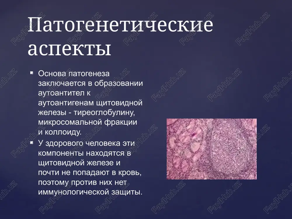 i gumoralnogo zvena ispolzuetsya askorbinovaya kislota v doze 0;5-1 g/sut, eufillin - 0,15 g/sut, a takje glyukokortikoidi (prednizolon) v doze 15-20 mg/sut. v sluchae sochetaniya autoimmunnogo tireoidita s oftalmopatiey dozi glyukokortikoidov (prednizolona) uvelichivayutsya do 40-80 mg/sut. pri etom, esli doza previshaet 60 mg, lechebnaya doza preparata naznachaetsya cherez den s tselyu profilaktiki nedostatochnosti funktsii kori nadpochechnikov. vmesto prednizolona mogut bit ispolzovani drugie preparati (deksametazon) s sootvetstvuyushey korrektirovkoy dozi. pri naznachenii bolshix doz glyukokortikoidov lechenie sleduet provodit v usloviyax statsionara. lechenie eto zabolevanie, xarakterizuyusheesya vospalitelnim protsessom v shitovidnoy jeleze, kak polagayut, virusnoy etiologii, soprovojdaetsya destruktsiey tirotsitov. podostriy tireoidit (tireoidit de kervena) vajnuyu informatsiyu dayut rezultati palpatsii shitovidnoy jelezi, kotoraya uvelichena v razmerax, plotnaya, boleznennaya; mogut opredelyatsya i uchastki lokalnoy boleznennosti. u bolshinstva bolnix v nachalnom periode zabolevaniya nablyudayutsya yavleniya tireotoksikoza. obshiy gipergidroz, rasshirenie perifericheskix sosudov koji, taxikardiya, simmetrichniy melkorazmashistiy tremor vityanutix paltsev ruk. razvitie etoy simptomatiki obuslovleno razrusheniem kletok shitovidnoy jelezi …