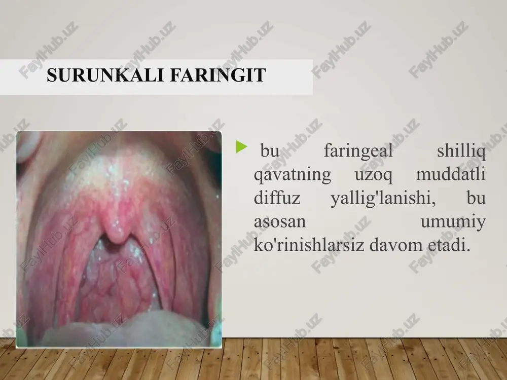 o'tkir va surunkali faringit - Page 5