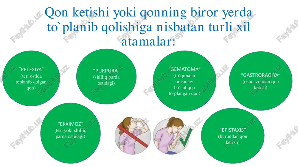 'lsa, ve- na tomirlari qisilib, ularda dimlanish vujudga keladi, arteriya tomirlari bosil- magani uchun gon ketish kamayma- yadi; agar o'ta qattiq tortilsa, to'qima- lar ezilishi bilan nerv tolalarida aso- ratlar paydo bo'lib, falajlanish yoki parezga olib kelishi mumkin. qon ketishni vaqtincha tuxtatish usullari shuning uchun nerv yo'llari yagin joylashgan yelka sohasida jgut go'yilganda ehtiyot bo'lishi lozim. vena gon tomiridan yoki kichik tomirlardan gon ketayotganda jgut qo'yilishi magsadga muvofiq emas. jgutning quyidagi kamchiliklari bor: 1. arteriyalar gisilishi bilan yumshog to'gimalar va nerv yo'llari ham eziladi, bu esa parez va falajlan- ishlarga olib kelishi mumkin. 2. jgut 2 soatdan ortiq go'yilsa, undan pastdagi to‘gimalarda qaytarib bo'lmaydigan jarayon - gan- grena vujudga keladi. qon ketishni vaqtincha tuxtatish usullari 3. qon aylanishining to'xtashi kislorodning to'gimalarda yetarli bo'lmasligiga olib keladi, bu bilan anaerob in- feksiya uchun qulay sharoit vujudga keladi, to'qimalarn- ing mikroblarga bolgan himoyaviy va _ regenerativ kuchlari pasayib ketadi. ~ buning uchun jgutni …