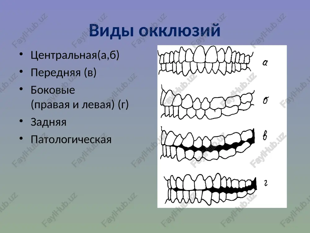 skoljenie vpered, v tsentralnuyu okklyuziyu, gde proisxodit maksimalniy fissurno- bugorkoviy kontakt. velichina etogo peremesheniya sostavlyaet 1-2 mm. (2) bokovie (transverzalnie) dvijeniya nijney chelyusti za schet sokrasheniya lateralnoy krilovidnoy mishtsi, protivopolojnoy storoni dvijeniya. sokrashenie etoy mishtsi poperemenno s odnoy i s drugoy storon sozdaet bokovie dvijeniya nijney chelyusti, sposobstvuyushie rastiraniyu pishi mejdu jevatelnimi poverxnostyami premolyarov i molyarov. na storone sokrativsheysya narujnoy krilovidnoy mishtsi (balansiruyushaya storona) nijnyaya chelyust dvijetsya vniz i vpered, a zatem pri konechnom dvijenii otklonyaetsya vnutr, to est proxodit opredelenniy put, imenuemiy transverzalnim sustavnim putem. pri otklonenii nijnechelyustnoy golovki v svoey konechnom dvijenii k seredine obrazuetsya ugol mejdu pervonachalnim i konechnim vektorom ee dvijeniya. vershina ugla naxoditsya na sustavnoy golovke. eto ugol nazvan uglom benneta i raven 15-17°. jevatelnie zubi na balansiruyushey storone ustanavlivayutsya drug protiv druga raznoimennimi bugrami. b r r b na drugoy storone (rabochaya storona) nijnechelyustnaya golovka, ostavayas v sustavnoy vpadine, sovershaet vrashatelnie dvijeniya vokrug svoey …