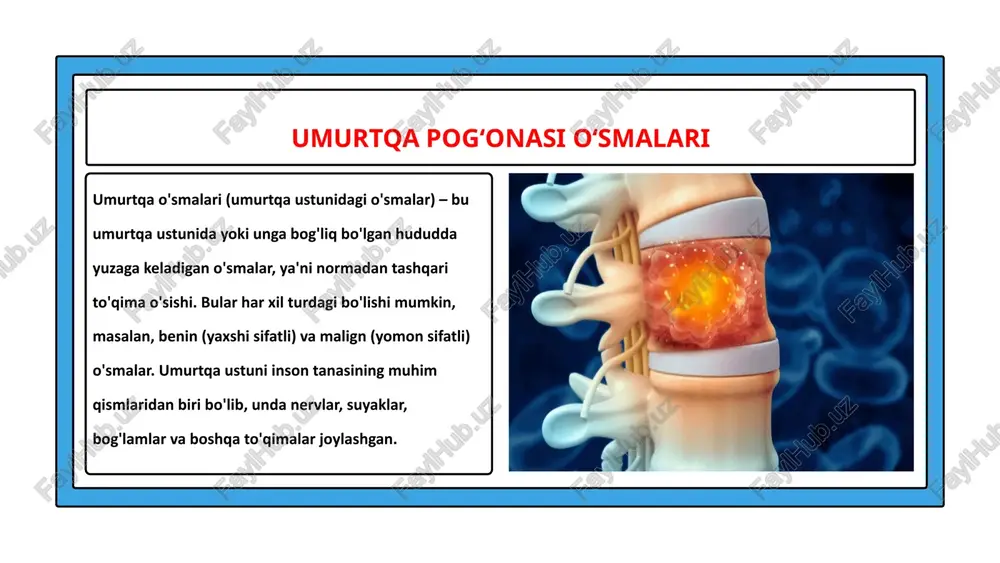 arab orqa miyaning quyidagi o‘smalari farqlanadi: kraniospinal; 2) bo‘yin; 3) ko‘krak; 4) bel-dumg‘aza; 5) epikonus; 6) konus; 7) «ot dumi» o‘smalari. kraniospinal o‘smalar – ustki qismi orqa kranial chuqurcha ichida, pastki qismi umurtqa kanali ichida joylashgan o‘smalar. bunday o‘smalar orqa kranial chuqurcha tuzilmalarini (uzunchoq miya, miyacha) va orqa miyaning yuqori qismini egallagan bo‘ladi. image1.png image2.jpeg image3.png image4.jpeg image5.png image6.png image7.png image8.jpeg image9.png image10.png image11.jpeg image12.png image13.jpeg image14.png image15.png