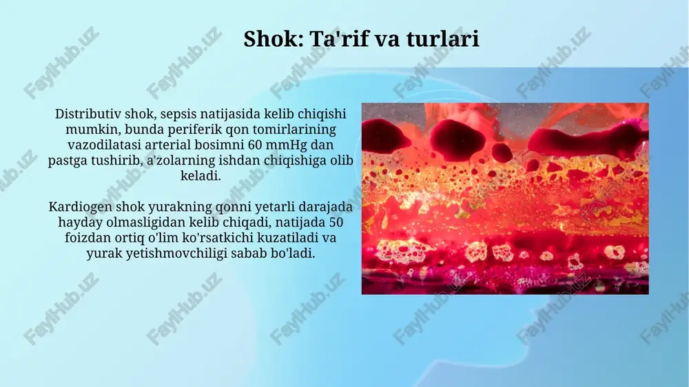 gemodinamika buzilishlari - Page 5