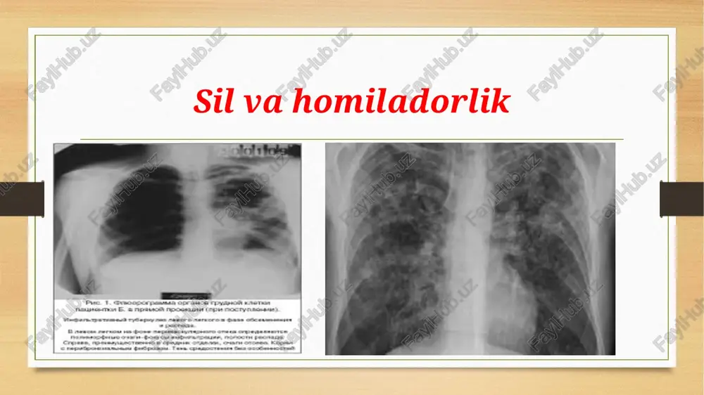 sil va homiladorlik - Page 5
