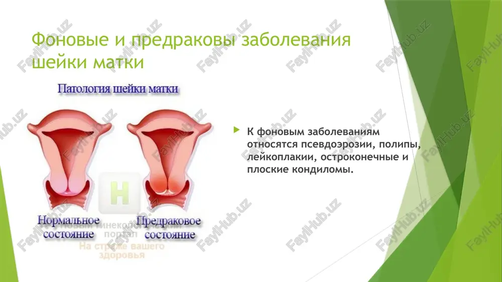onkologicheskie zabolevaniya jenskix polovix organov - Page 5