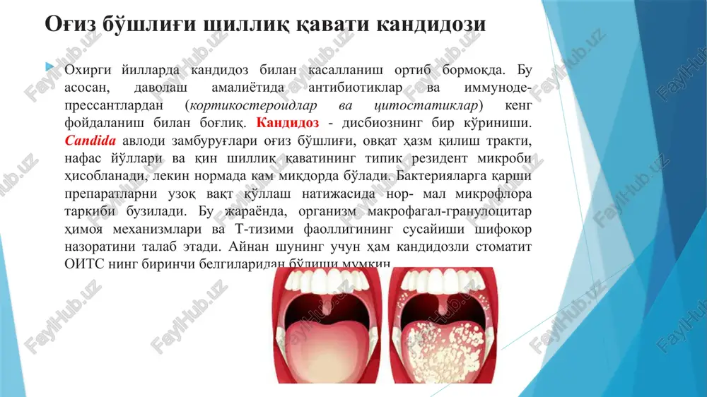 g'ichlarining yo'qolishi, leykoplakiya va kandidozli glossitlar ham ta'riflangan. kandidozning rivojlanishida og'izning shilliq qavati va uning mahalliy immuniteti katta ahamiyatga ega. og'iz shilliq qavatini tishlarning o'tkir qirralari, sifatsiz yasama tishlar, parchalangan tish qoplamalari va boshqalar bilan uzoq vaqt jarohatlanishi oqibatida ham kandidoz vujudga keladi. surunkali jarohatlar natijasida og'iz bo'shlig'i shilliq qavatining rezistentligi pasayadi, so'ng unga candida larning kirishi osonlashadi va kasallik yuzaga keladi. bundan tashqari, candida urug'iga mansub zamburug'lar akril plastmassadan tayyorlangan olib qo'yiladigan yasama tishlar yuzasida yaxshi o'sadi va yasama tish ostidagi shilliq qavatning surunkali yallig'lanishini keltirib chiqaradi. o'tkir atrofik kandidoz kuchli og'riq, achishish va og'izning qurishi kabi belgilar bilan tavsiflanadi. shilliq qavat tiniq qizil rangga kiradi, lekin quruq bo'ladi. til zararlanganda, uning orqasi qizil rangiga kiradi, yaltiroq, quruq bo'ladi, ipsimon so'rg'ichlari atrofiyalanadi. fasod bo'lmaydi yoki chuqur buramalarida saqlanib qolishi mumkin, u ko'chgan epiteliyning konglomerati hisoblanib, qiyinchilik bilan ko'chadi va ko'p miqdorda candida urug'i zamburug'larini tutadi. bu zamburug'lar faol kurtaklanish …