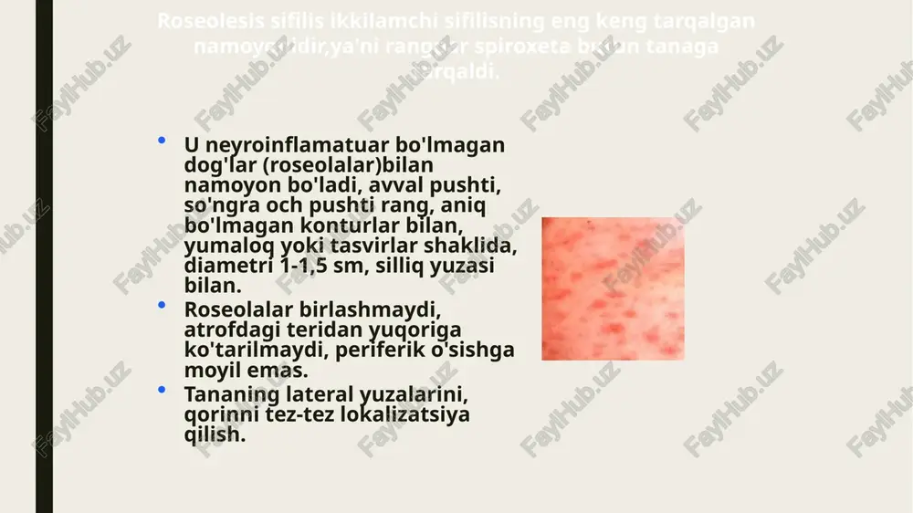 anglarda (pushti, jigarrang, oq ). chandiqda hech qachon yangi tüberkler paydo bo'lmaydi. tuberkulyozlar titroq shaklida paydo bo'ladi, ularning rivojlanishi sekin, uzoq davom etadi - bir necha oydan bir necha yilgacha. guruhlangan, serpiginatsiya qiluvchi, mitti va tuberkulyar sifilisni "platforma"bilan ajrating. 26 tuberkulyar sifiliz 27 gummoz sifiliz sifilitik gumma-bu sharsimon shakldagi yallig'lanish tuguni, zich tutarlılık, uning ustidagi teri mis-qizil rangga ega. gumma asta-sekin kattalashib boradi, uning rangi jigarrang yoki mavimsi rangga ega bo'ladi. keyin gumma ochiladi. olingan teshikdan juda ko'p miqdordagi shaffof, yopishqoq, elimga o'xshash suyuqlik ajralib chiqadi ("gumma" nomi lotincha "gummi"dan olingan-saqich, ko'plab daraxtlar zararlanganda po'stloq yuzasida chiqadigan va odatda tez qotib qoladigan qalin sharbat). teshik kattalashib, yaraga aylanadi. gummoz yarasi yumaloq shaklga ega, tekis, rulonli ko'tarilgan, ochilmagan qirralari bor. yaraning o'ziga xos klinik belgisi gummoz tayoqchadir – yaraning pastki qismida mahkam o'rnashgan iflos kulrang yoki seroz sariq nekrotik massalar. gummoz tayoqchani rad etgandan so'ng, yara yaralanadi. ba'zida gumma yaralanmaydi va …