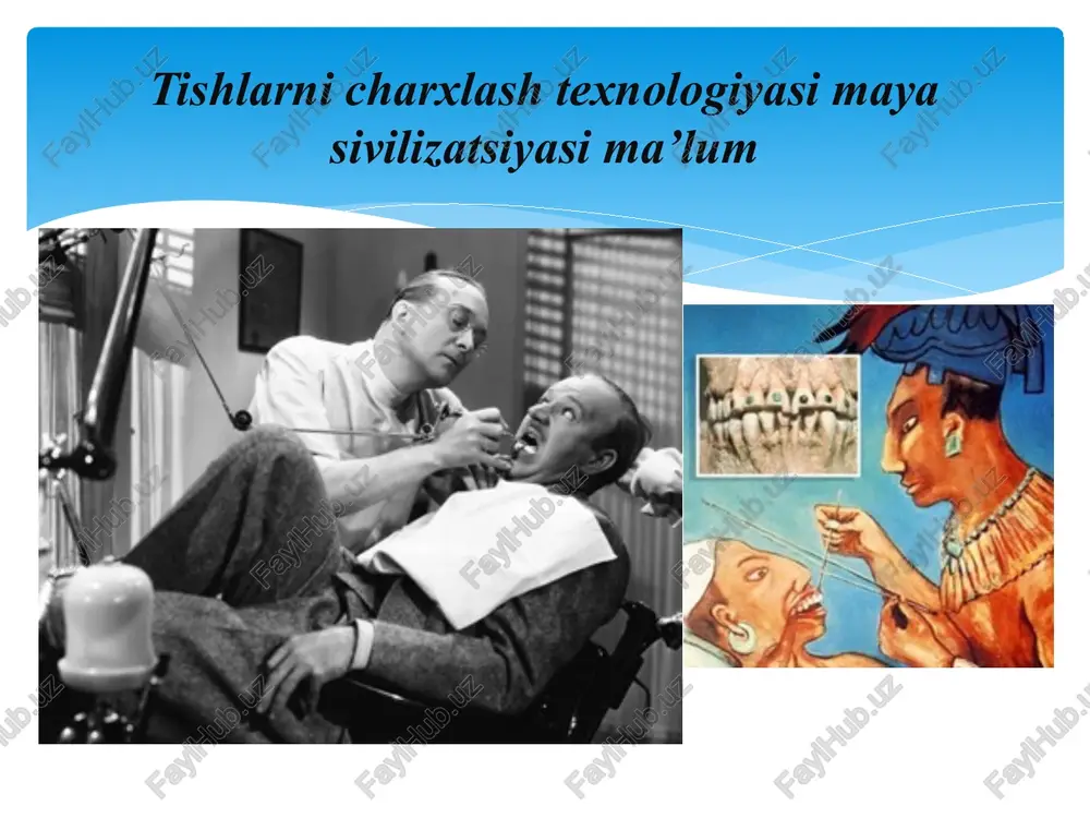 na kajduyu dopolnitelnuyu stomatologicheskuyu ustanovku (7 m2 na dopolnitelnoe stomatologicheskoe kreslo bez ustanovki) kabinet vracha v obsheobrazovatelnix uchrejdeniyax 12 kabinet gigieni rta 10 s uchetom ogranichennogo ob'ema lechebnoy raboti xonaning maydoni asosiy stomatologik kreslo uchun kamida 14 m2 maydon, har bir qo'shimcha uchun 7 m2 yoki universal stomatologik o'rnatish bilan har bir qo'shimcha stul uchun 10 m2. bunday maydon stomatologik jihozlarni joylashtirish va shifokorning qulay ishlashi uchun etarli. xonaning balandligi bir kishi uchun minimal 12 kub metr havoni ta’minlash maqsadida 3 metrdan kam bo’lmasligi kerak. xonaning chuqurligi ish joylarining tabiiy yoritilishi yomonlashishi mumkinligi sababli 6 m dan oshmasligi kerak. terapevt-stomatolog xonasi kabinet vracha ortopeda stomatologa kabinet xirurga-stomatologa jarroh-stomatolog xonasi image2.png image3.png image4.png image5.jpeg image6.jpeg image7.png image8.png image9.jpeg image10.jpeg image11.jpeg image12.jpeg image13.jpeg image14.jpeg image15.jpeg image16.jpeg image17.jpeg image18.jpeg image19.jpeg image20.jpeg image21.jpeg image22.jpeg image23.jpeg image24.jpeg image25.jpeg image26.jpeg image27.jpeg image28.jpeg image29.jpeg image30.jpeg image31.jpeg image32.jpeg image33.jpeg image34.jpeg image35.jpeg image36.jpeg image37.jpeg /docprops/thumbnail.jpeg