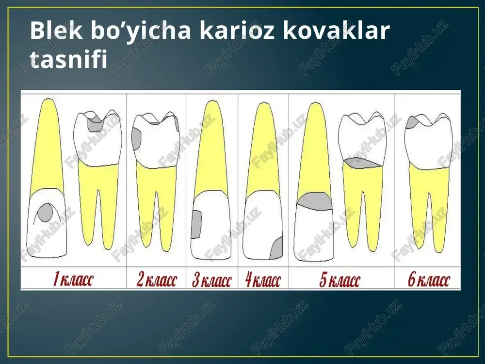 preklinik stomatologiya - Page 5