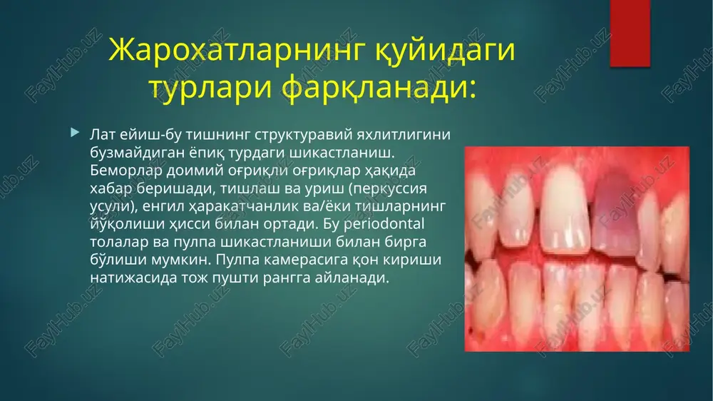 klinik restavratsion stomatologiya - Page 5