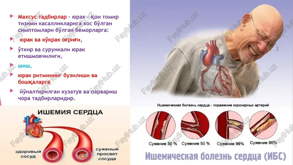 suyuqlik to'planadi. agar bemor yursa yurak shishlari ko'proq oyoqlarda, agar yotsa dumg'aza, bel, kurakda lokalizatsiyalanadi. shish sohasida teri silliq, yaltiroq, tortilgan, bosib ko'rilganda uzoq tiklanmaydigan chuqurcha paydo bo'ladi. uzoq davom etuvchi yurak etishmovchiligi natijasida seroz bo'shliqlarda suyuqlik (transsudat) to'planadi. -assit (grek. askite- shishkan) - qorin bo'shlig'ida suyuqlik yig'ilishi. -gidrotoraks (grek. gidro –suv, suyuqlik, toraks-ko'krak qafasi)- suyuqlikni plevra bo'shlig'ida yig'ilishi. -gidroperikard (gidro+ perikard)- suyuqlikni perikard bo'shlig'ida yig'ilishi. -anasarka (grek. ana- barcha, sarcus-go'sht) – teri osti yog' qavatida tarqalgan shish. anasarka avval “hydor ana sarcus” termini bilan nomlangan (grek. grek. hydor-suyuqlik), bu suyuqlikni butun go'sht aniqrog'i tana bo'ylab degan ma'noni bildiriladi. natijada “ hydor ” so'zi qo'llanilmay qo'ydi va tarqalgan shish qisqa qilib “ana sarcus”- anasarka deb nomlandi. shuni yodda tutish kerakki, kasallikning dastlabki bosqichlarida shish yashirin ko'rinishda bo'lishi mumkin. bunday hollarda organizmda suyuqlikning turib qolishi tana vaznining tez ortishi va diurezning kamayishi bilan namoyon bo'ladi. shuning uchun ham bunday bemorlarda sutkalik …
