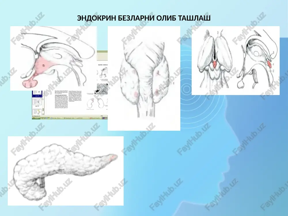 bemor imkon qadar kamroq qon yo'qotishi kerakligini anglatadi. ushbu tamoyil kesma yo'nalishini tanlashda kuzatilishi kerak (shikastlanish ehtimolini kamaytirish uchun to'qimalarni eng katta tomirlar yo'nalishiga parallel ravishda ajratish tavsiya etiladi). biroq, to'qimalarni ajratish jarayonida tomirlar muqarrar ravishda shikastlanadi va jarrohning vazifasi qon ketishini o'z vaqtida to'xtatishdir. birlamchi jarrohlik ishlov berish jarroh tomonidan amalga oshiriladi. kichik asoratlanmagan yaralar poliklinikada yoki boshqa ixtisoslashtirilgan tibbiyot muassasasida ambulatoriya sharoitida davolanadi. keng qamrovli murakkab jarohatlar kasalxonaning operatsiya xonasida utkaziladi. qayta ishlash jarayonida kesish, tikuv va kiyinish materiallari (skalpel, qisqichlar, ilgaklar, pinset, igna ushlagichli ignalar, iplar, drenajlar, bintlar) ishlatiladi. etiboringiz uchun rahmat! image1.png image2.png image3.png image4.png image5.png image6.png image7.png image8.png image9.png image10.png image11.png image12.png image13.jpeg image14.png image15.png image16.png image17.png image18.png image19.png image20.png image21.png image22.png image23.png image24.png image25.png image26.png /docprops/thumbnail.jpeg
