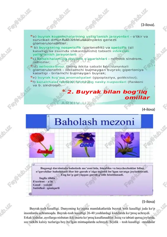 rning ko‘payishi oqibatida siydik– tosh kasalligining uchrashi keyinchalik o‘sib borishi juda ko‘p uchramoqda. toshlar siydik ajratish tizimlarining barcha qismlarida: kosachalarda, jomda, siydik naylarida, qovuqda va siydik chiqarish kanalida joylashishi munkin. ko‘p hollarda toshlar buyraklarning birortasida hosil bo‘ladi, ammo 9–17 % hollarda siydik–tosh kasalligi ikki tomonlama xarakterga ega. buyrakda toshlar bitta yoki bir necha (ko‘p toshlar ko’pincha g’ovaksimon buyrakda kuzatiladi) bo’lishi munkin. kuzatuvlardan ma’lumki, ba’zan buyrakda 5000 ta gacha toshlar ham topilgan. toshlar har xil kattalikda 1 mm dan 10 sm gacha va undan katta, massasi 1000 g gacha bo’lishi munkin. buyraklar va siydik yo‘llarida aniqlangan toshlar. 25–32% hollarda siydik–tosh kasalligi yana qaytalanadi, bunda murakkabroq klinik ko‘rinishga ega bo‘ladi. toshlarning o‘sish tezligi nihoyatda individual. ba’zi toshlar bir necha yil davomida o‘smay turaveradi va bemorlarga bilinmaydi, marjonsimon toshlar 6–12 oy ichida jomning va buyrak kosachalarining barcha qismida bo‘lishi munkin. etiologiyasi va patogenezi. hozirgi vaqtgacha siydik – tosh kasalligi patogenezining yagona nazariyasi mavjud …